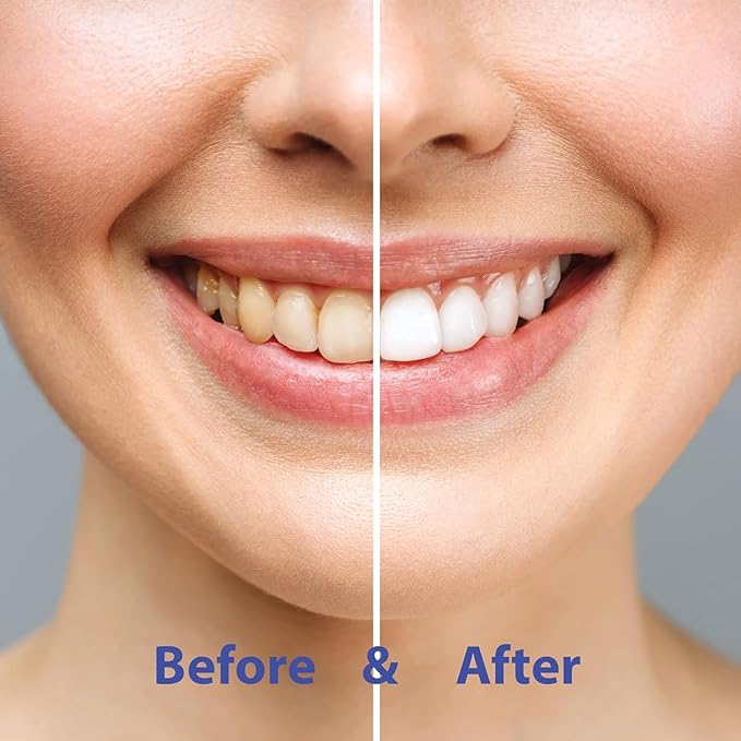 CHOMP Super Whitening Peppermint Toothpaste Tablets Refill